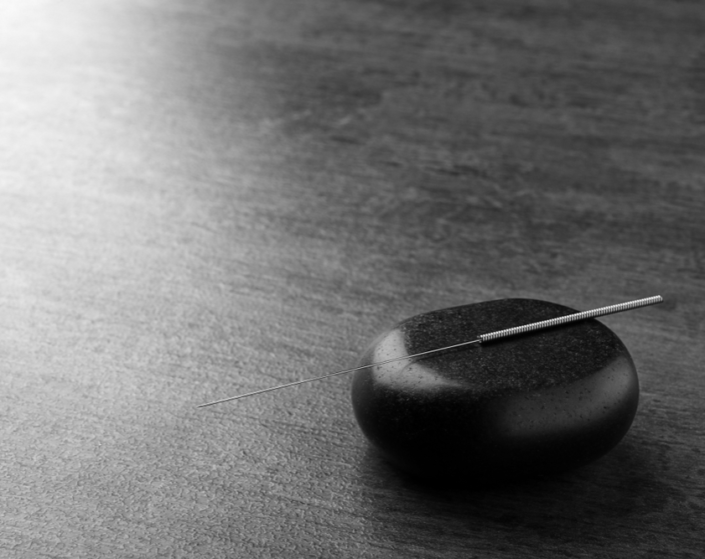 Acupuncture